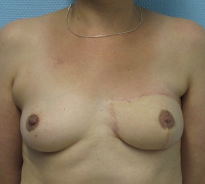 Centre Oncologie Poitiers