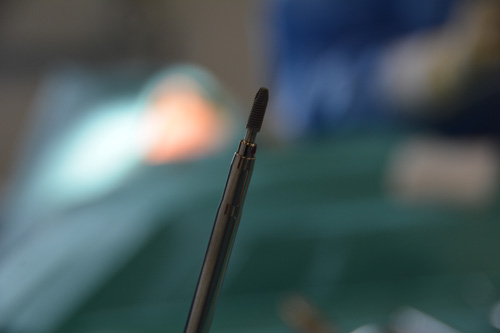 Implant en titane