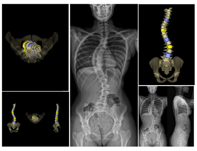 figure14b