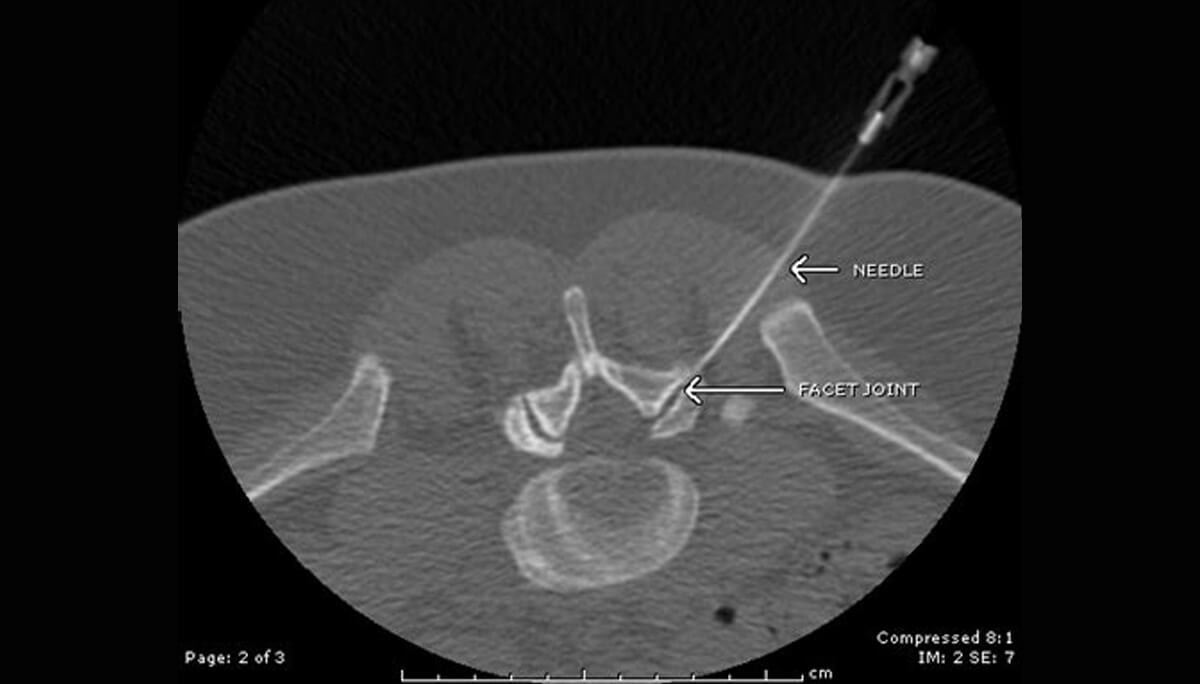 figure16