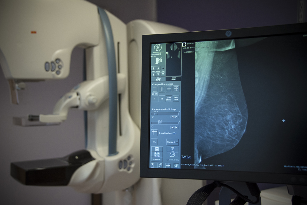 Mammographe numérique