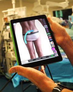 Une interface sur tablette tactile permet au patient de localiser et de qualifier la douleur au moment du positionnement et du paramétrage de l'électrode.