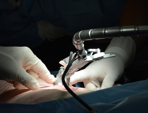 Neurostimulation médullaire : des neurochirurgiens du monde entier viennent se former à Poitiers