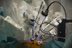 Chirurgie thoracique : retrait d'une tumeur du poumon avec le robot chirurgical Da Vinci par le Pr Christophe Jayle, au CHU de Poitiers