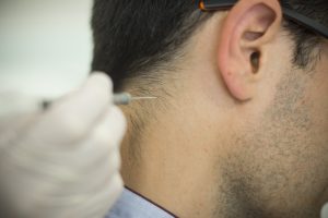 Le Dr Benatru, neurologue au CHU de Poitiers, injecte de la toxine botulinique dans les muscles du cou des patients atteint de dystonie cervicale pour les relâcher et leur permettre de retrouver une plus grande liberté de mouvement.
