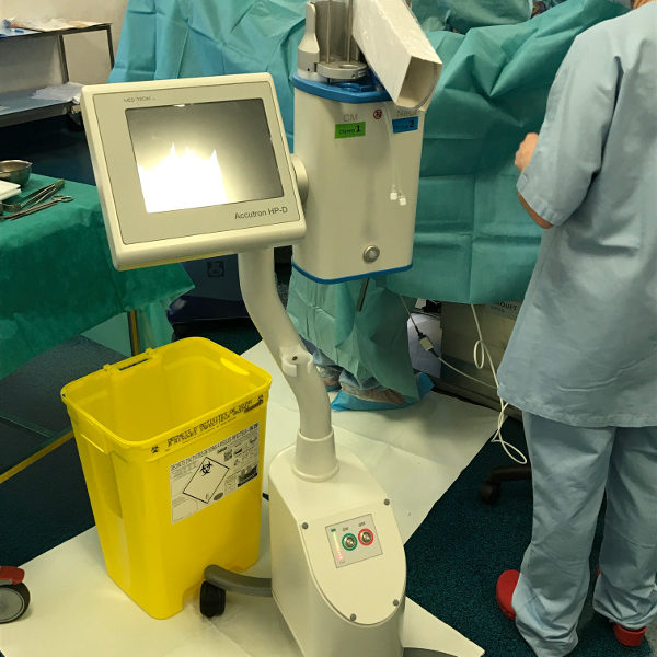 IMG_0304 Une buse de nébulisation reliée à un injecteur haute pression diffuse la chimiothérapie dans tout l’abdomen, puis le produit est laissé pendant une demi-heure dans le corps du patient avant d’être aspiré.
