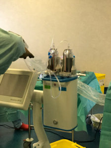 Une buse de nébulisation reliée à un injecteur haute pression diffuse la chimiothérapie dans tout l’abdomen, puis le produit est laissé pendant une demi-heure dans le corps du patient avant d’être aspiré.